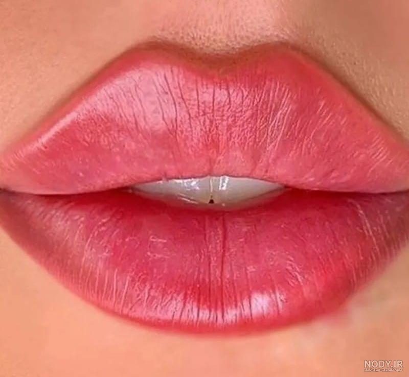 تزریق ژل لب درد دارد؟ عوارض، انواع+ نحوه تزریق لب -دکترمایکو تزریق ژل لب درد دارد؟ عوارض، انواع+ نحوه تزریق لب -دکترمایکو