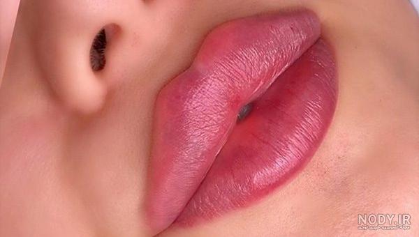 تزریق ژل لب روسی با بالاترین کیفیت و کمترین هزینه در کلینیک نیوشا تزریق ژل لب روسی با بالاترین کیفیت و کمترین هزینه در کلینیک نیوشا
