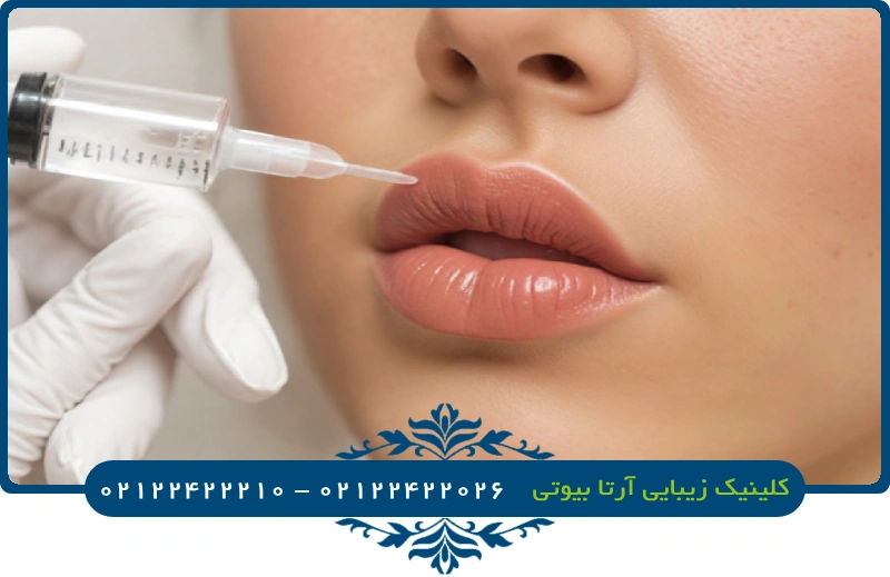 تزریق ژل لب قلبی + قیمت ژل لب مدل قلبی بهترین برند (نمونه کار 1403) تزریق ژل لب قلبی + قیمت ژل لب مدل قلبی بهترین برند (نمونه کار 1403)