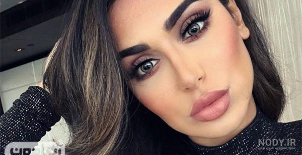 تزریق ژل لب مدل عروسکی | قیمت+ فیلم و نمونه کارها- دکتر مهدی اوصیا