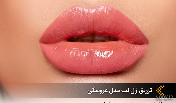 تزریق ژل لب مدل عروسکی چگونه است؟ + تصاویر - زیبامون