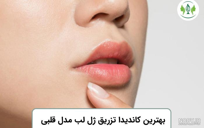 تزریق ژل لب مدل قلبی : راز داشتن لب‌هایی جذاب و دلربا