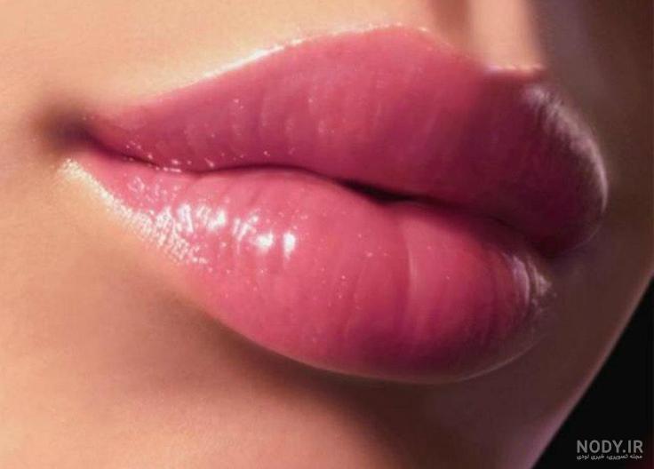 تزریق ژل لب مدل قلوه ای + نحوه تزریق و ماندگاری ✓ | دکتر حمیدرضا بهمنی تزریق ژل لب مدل قلوه ای + نحوه تزریق و ماندگاری ✓ | دکتر حمیدرضا بهمنی