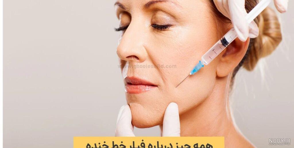 تزریق ژل لب چاک دار و هر آنچه بایستی در این مورد بدانید - کلینیک دلتا تزریق ژل لب چاک دار و هر آنچه بایستی در این مورد بدانید - کلینیک دلتا