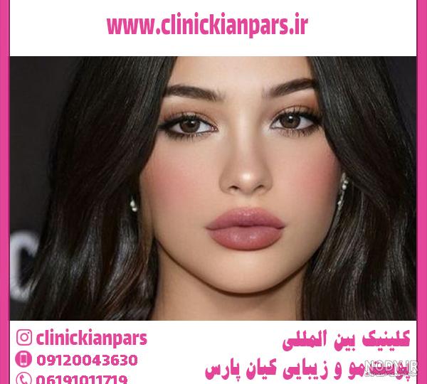 تصاویر قبل و بعد از تزریق ژل