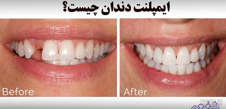 تصویر با کیفیت دندان تصویر با کیفیت دندان