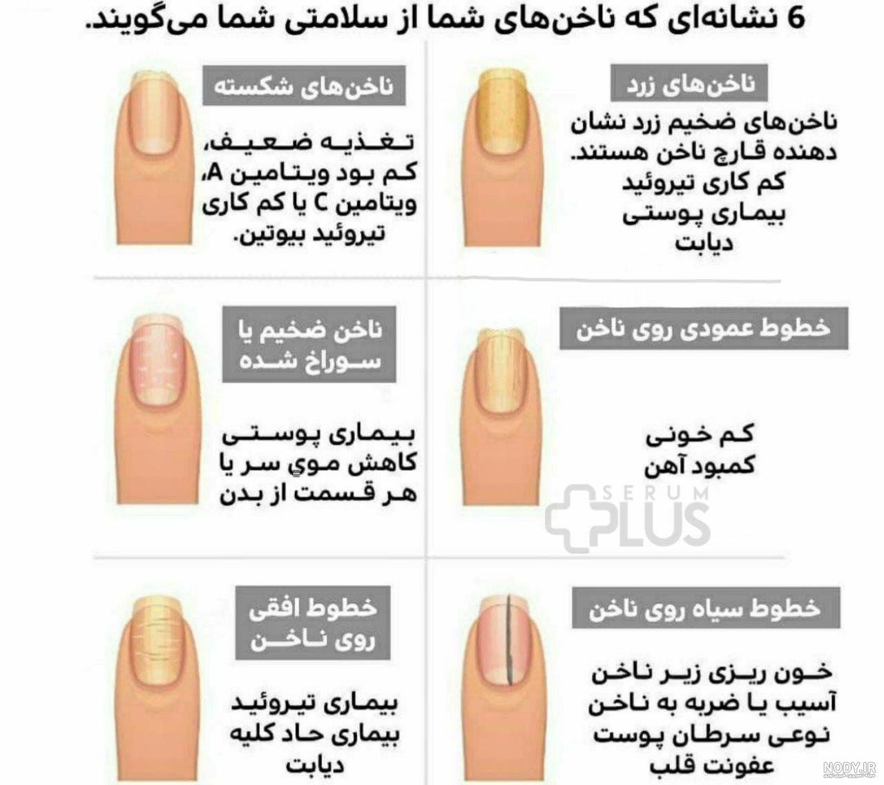 تعبیر خواب شکستن ناخن دست و پا چیست و چه معنی دارد؟ تعبیر خواب شکستن ناخن دست و پا چیست و چه معنی دارد؟