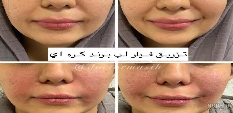 جذاب ترین و خاص ترین مدل های ارایش لب کره ای! جذاب ترین و خاص ترین مدل های ارایش لب کره ای!
