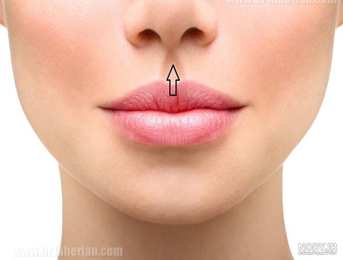 جراحی زیبایی لیفت لب برای جوان سازی لب ها جراحی زیبایی لیفت لب برای جوان سازی لب ها