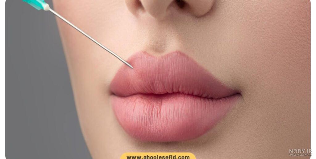 خرمشهر اَپ. تزریق فیلر (ژل) لب (40 دقیقه) خرمشهر اَپ. تزریق فیلر (ژل) لب (40 دقیقه)