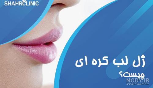 خرید تینت لب کره ای - بُم شاپ فروشگاه کره ای خرید تینت لب کره ای - بُم شاپ فروشگاه کره ای