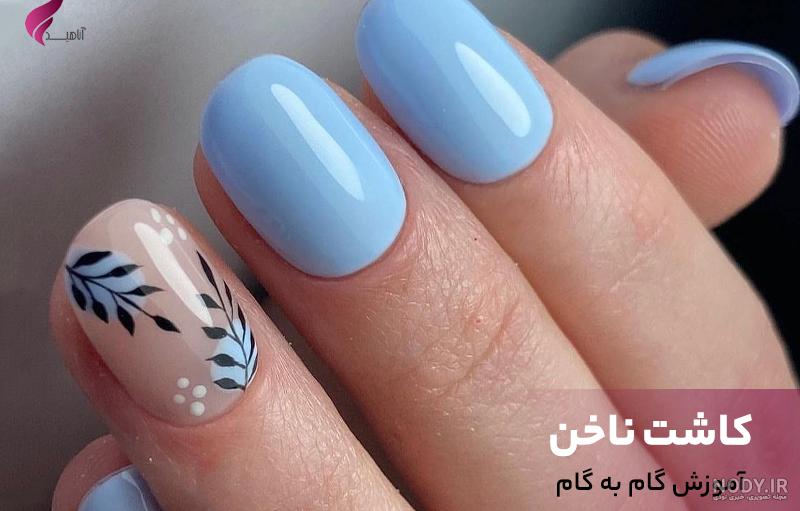 درمان قارچ ناخن کاشت شده درمان قارچ ناخن کاشت شده
