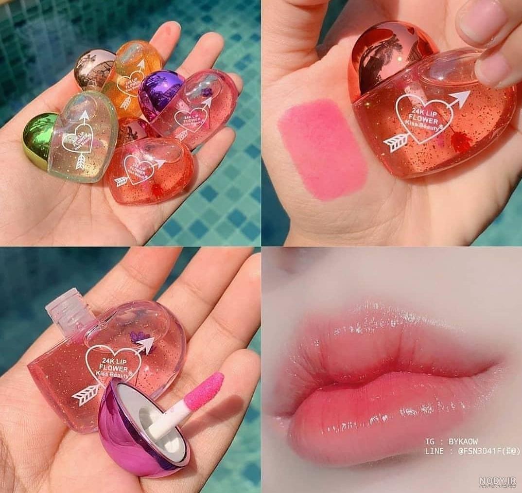 دکتر تزریق ژل در اندیشه فاز 3 ❤️ فیلم قبل و بعد + تعرفه و قیمت ها - عوارض  وانواع ژل