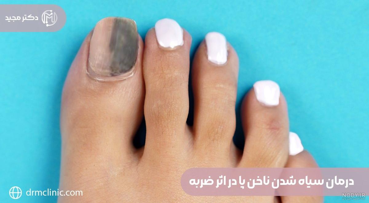 رنگ لاک مناسب: طرح لاک ناخن برای روز ولنتاین رنگ لاک مناسب: طرح لاک ناخن برای روز ولنتاین