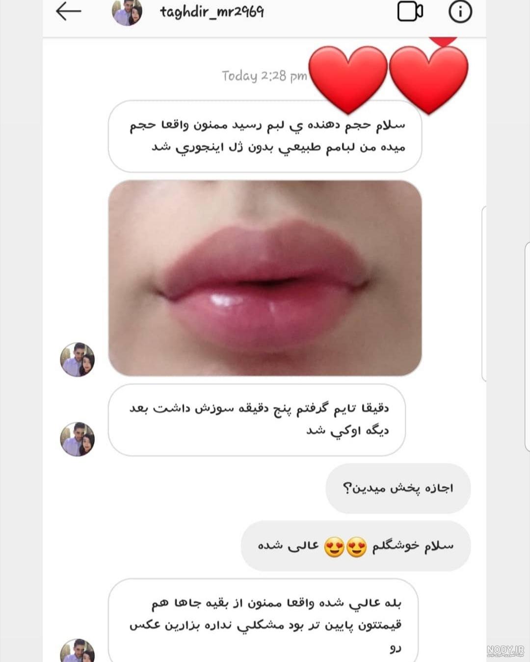 رژ لب حجم دهنده شیگلم Sheglam - فروشگاه اینترنتی لاروژ
