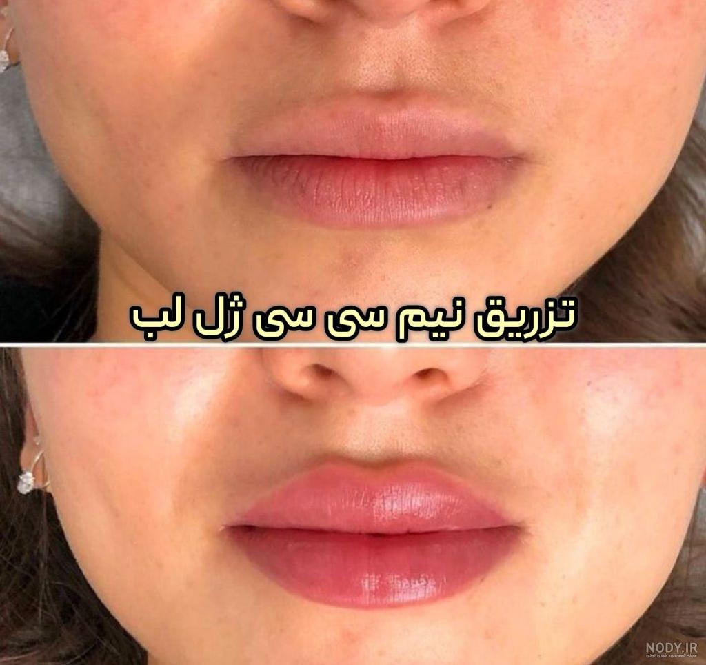 زشت ترین خانم باربی جهان با پروتز لب / خانم لب شتری را ببینید ! + عکس ها قبل و بعد جراحی زیبایی زشت ترین خانم باربی جهان با پروتز لب / خانم لب شتری را ببینید ! + عکس ها قبل و بعد جراحی زیبایی