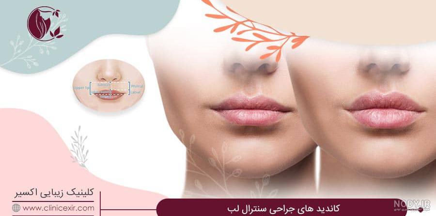 سانترال لب - کلینیک زیبایی پوست آراکام سانترال لب - کلینیک زیبایی پوست آراکام