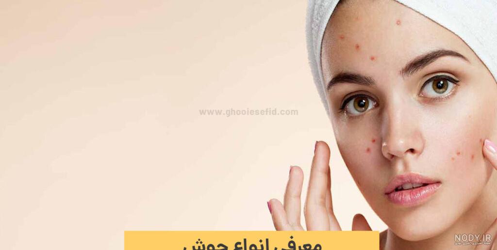 شما چه نوع لب هایی دارید؟ - دکتر عباس خیرخواه شما چه نوع لب هایی دارید؟ - دکتر عباس خیرخواه