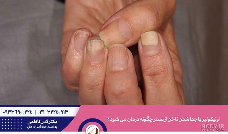 طراحی ناخن قلب ساده شیک و مینیاتوری برای روز عشق طراحی ناخن قلب ساده شیک و مینیاتوری برای روز عشق