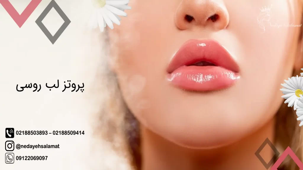 طنز خنده دار سیما :: پروتز لب طنز خنده دار سیما :: پروتز لب