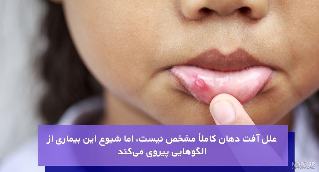 عوارض پوستی بوسیدن نوزاد عوارض پوستی بوسیدن نوزاد