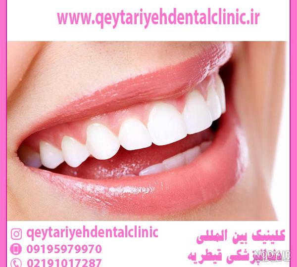 عکس با کیفیت تبلیغاتی دهانی با لبخند زیبا - لایه باز طرح آماده psd - eps عکس با کیفیت تبلیغاتی دهانی با لبخند زیبا - لایه باز طرح آماده psd - eps