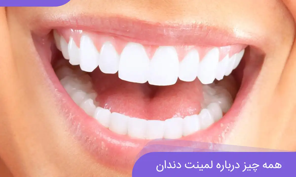 عکس زیباترین دندان های دنیا - کلینیک دندان پزشکی قیطریه تهران عکس زیباترین دندان های دنیا - کلینیک دندان پزشکی قیطریه تهران
