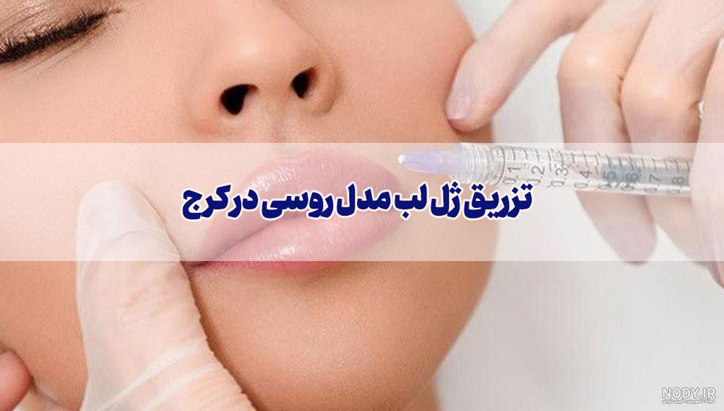 عکس فیلر لب مدل روسی عکس فیلر لب مدل روسی