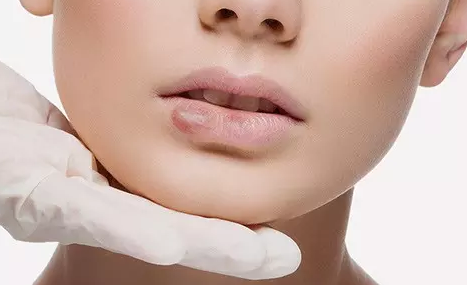 عکس های لب جوش
