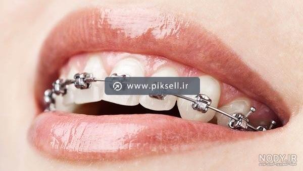 عکس لب و دندان - عکس نودی عکس لب و دندان - عکس نودی