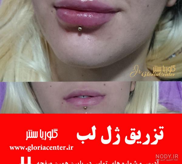 عکس لب پروتز شده عروسکی ۱۴۰۰ - عکس نودی عکس لب پروتز شده عروسکی ۱۴۰۰ - عکس نودی