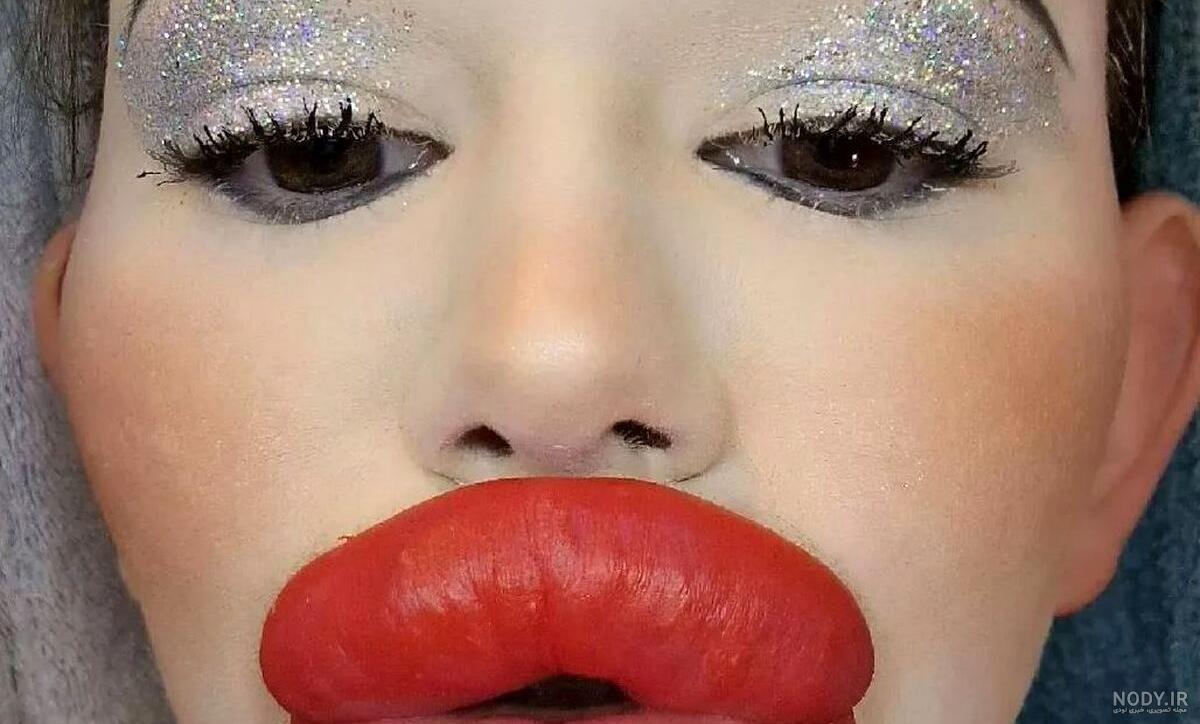 عکس لب پروتز گنده عکس لب پروتز گنده