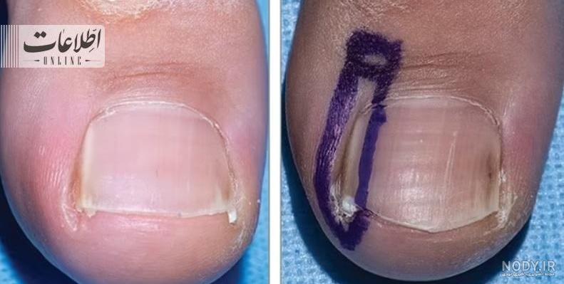 عکس ناخن های عجیب و غریب