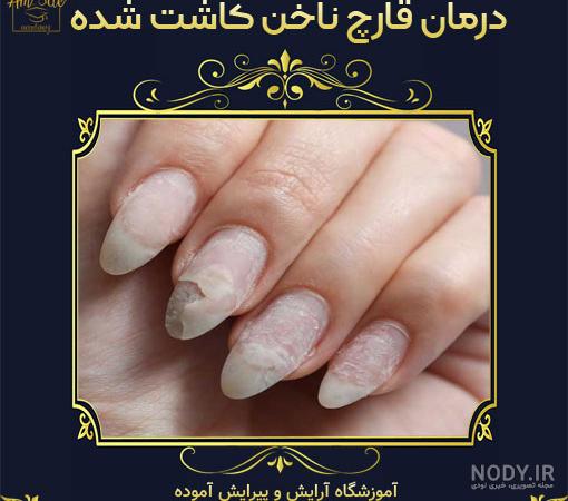 عکس هوا گرفتن ناخن عکس هوا گرفتن ناخن