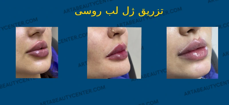 عکس های پوست و مو عکس های پوست و مو