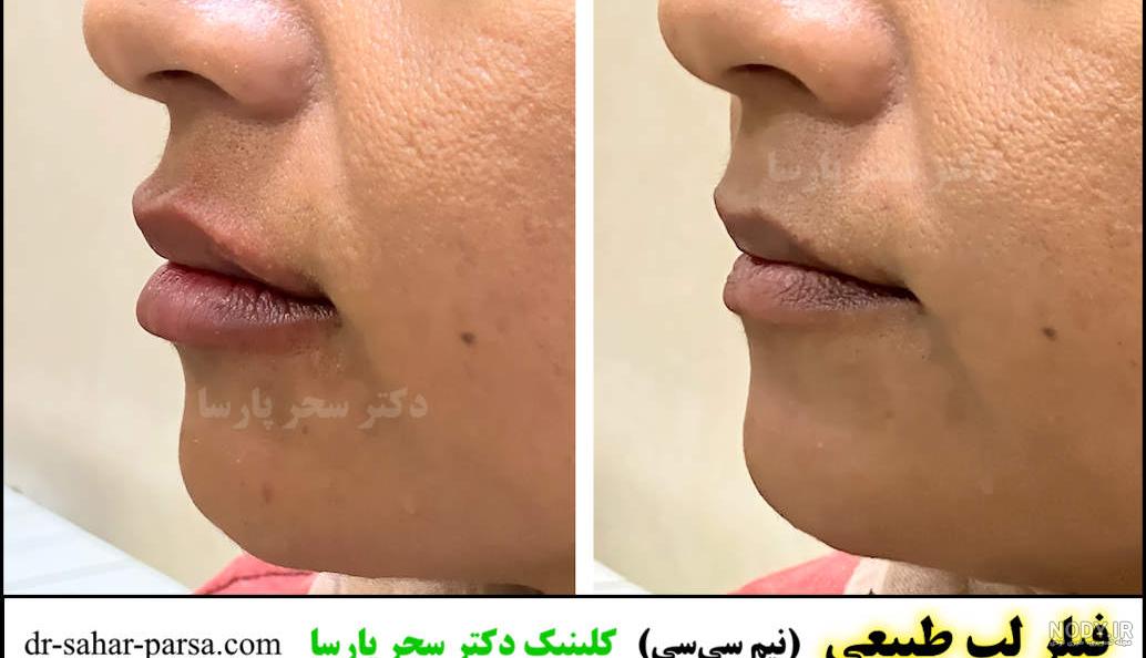 عکس ژل لب خنده دار عکس ژل لب خنده دار