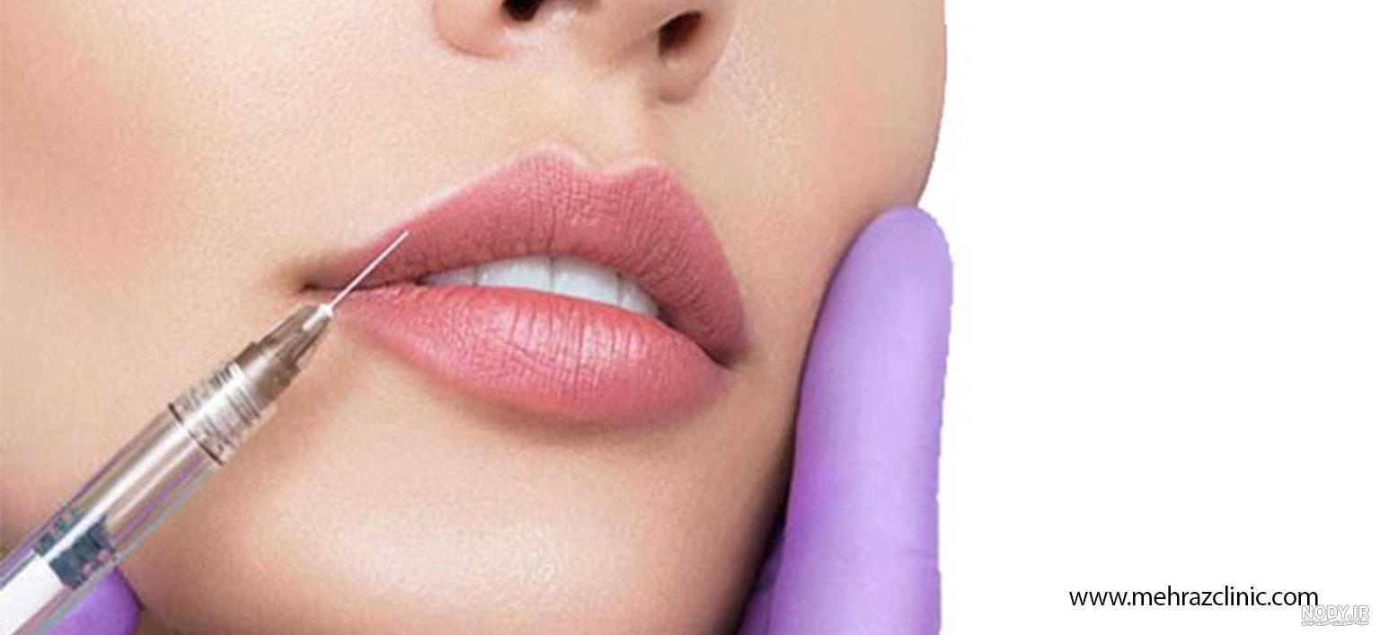 عکس ژل لب مدل کره ای عکس ژل لب مدل کره ای
