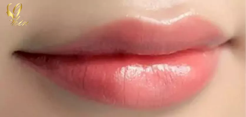 عکس ژل لب کره ای عکس ژل لب کره ای
