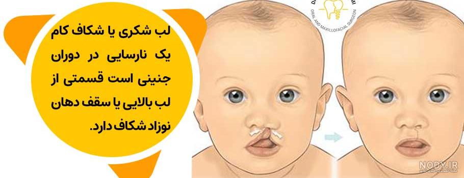 عکس کوچک ترین لباس عکس کوچک ترین لباس