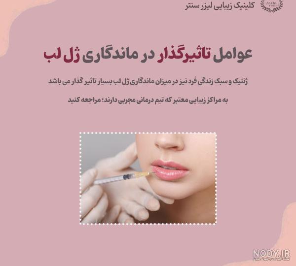 فیلر لب کره ای به زیبایی گیلاس – کلینیک دندانپزشکی فیلر لب کره ای به زیبایی گیلاس – کلینیک دندانپزشکی