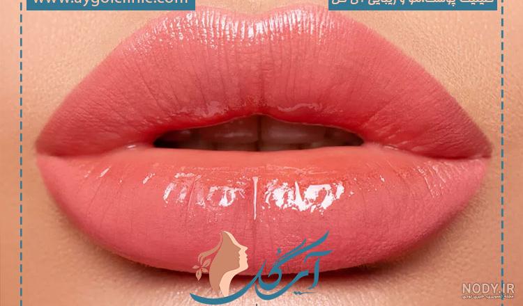 قیمت تزریق ژل لب روسی در کرج 1402 با قیمت مناسب + عکس و نمونه کار قیمت تزریق ژل لب روسی در کرج 1402 با قیمت مناسب + عکس و نمونه کار