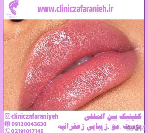 قیمت و خرید ژل لب پرفکتا دیپ فرانسوی - مدیکال طب قیمت و خرید ژل لب پرفکتا دیپ فرانسوی - مدیکال طب