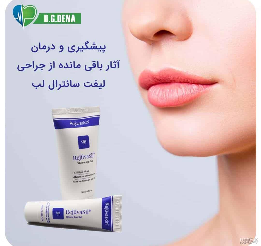 قیمت سانترال لب در سال 1403 چقدر است؟ قیمت سانترال لب در سال 1403 چقدر است؟