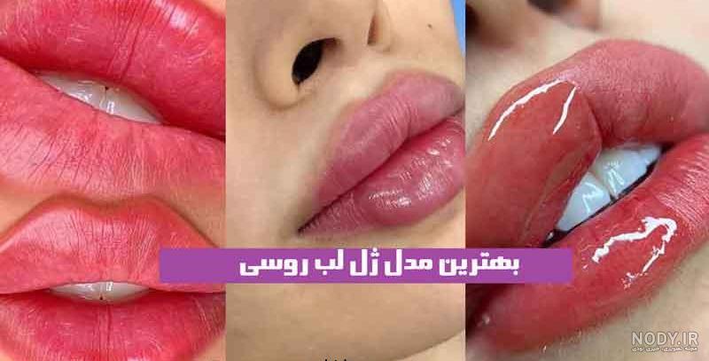 لب - اصلاح فرم لب با لیزر - تغییر فرم لب با لیزر - کلینیک تخصصی Dencare لب - اصلاح فرم لب با لیزر - تغییر فرم لب با لیزر - کلینیک تخصصی Dencare