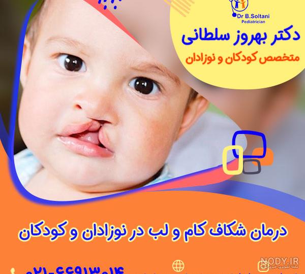 لب شکری یا شکاف لب چیست؟ راه های درمان لب شکری | پذیرش۲۴ لب شکری یا شکاف لب چیست؟ راه های درمان لب شکری | پذیرش۲۴