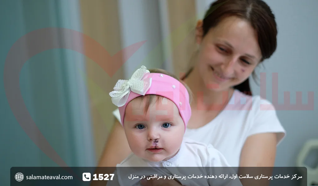 لب شکری یا شکاف لب چیست؟ راه های درمان لب شکری | پذیرش۲۴