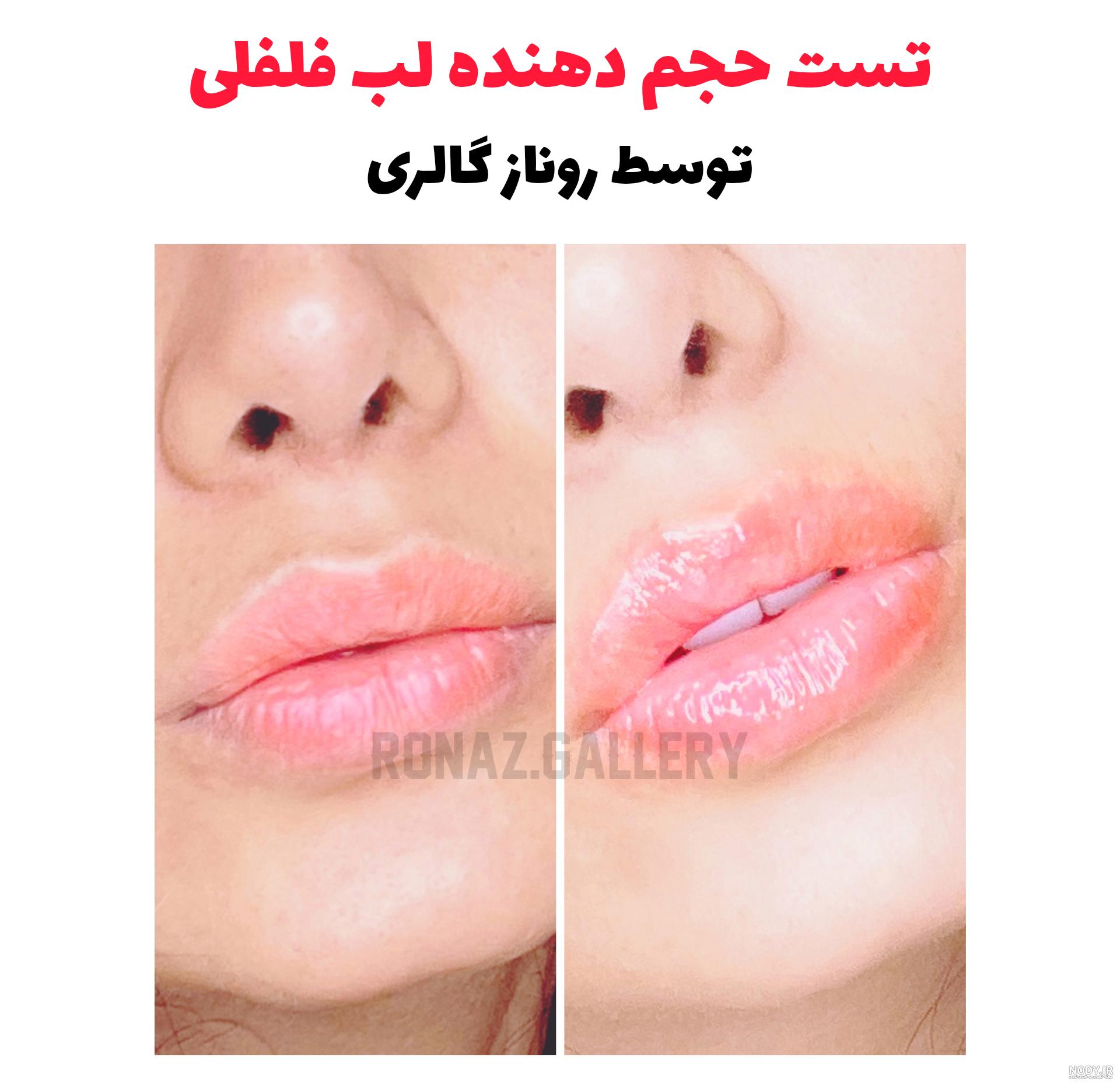 لیپ گلاس حجم دهنده لب شیگلم مدل Ice Queen - ژینوس
