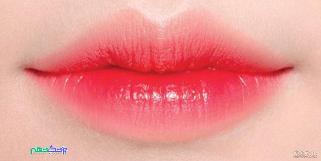 ماندگاری ژل لب | کلینیک لیزر سنتر ماندگاری ژل لب | کلینیک لیزر سنتر