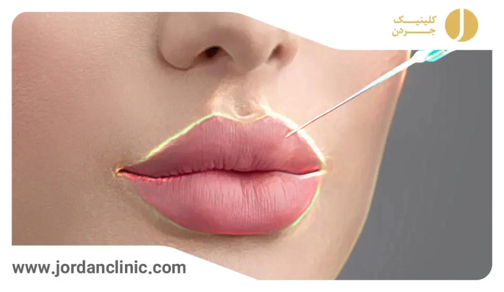 مدل ژل لب عروسکی و روسی + مدل های نچرال و قلوه ای