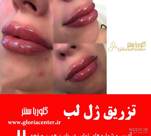 مدل ژل لب عروسکی و روسی + مدل های نچرال و قلوه ای